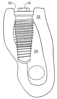 Nobel-Dental-Patent.jpg